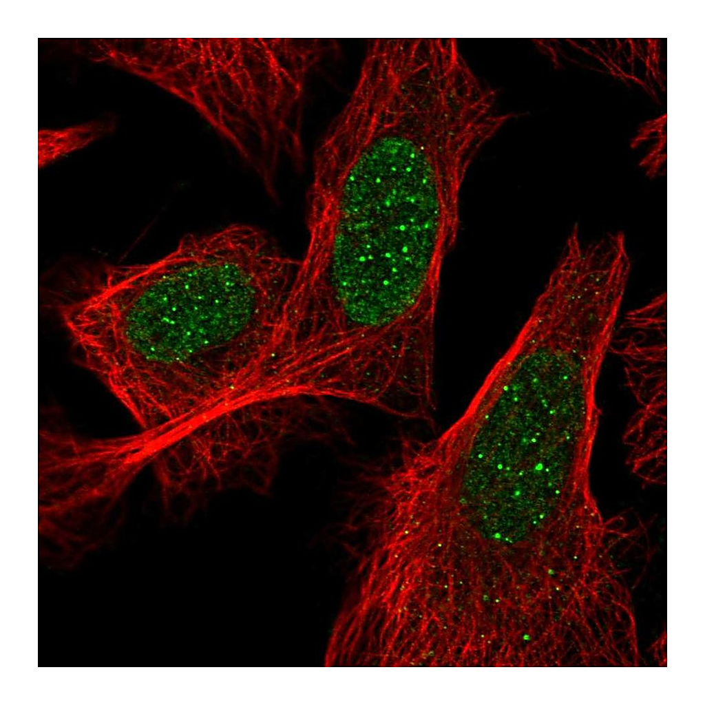 Atlas Antibodies Anti-ACD Antibody