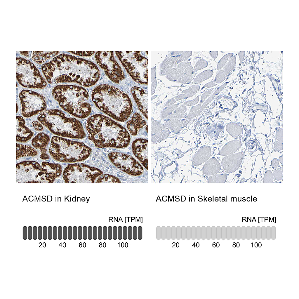 Atlas Antibodies Anti-ACMSD Antibody