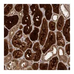 Atlas Antibodies Anti-ACO1 Antibody