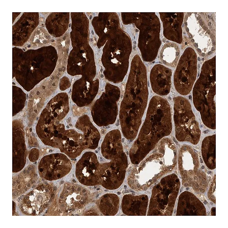 Atlas Antibodies Anti-ACO1 Antibody