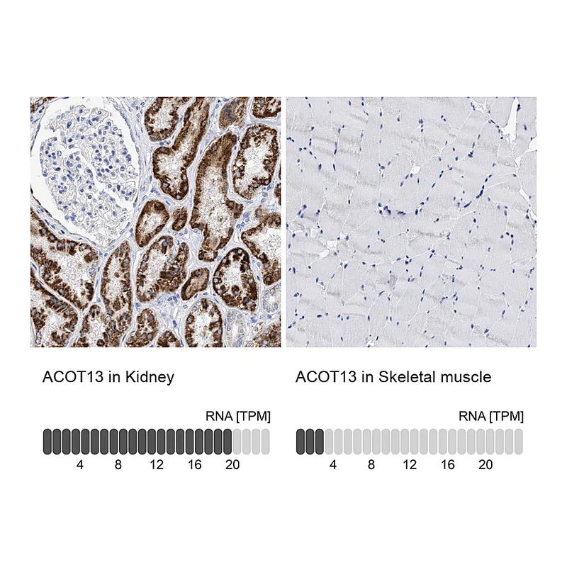 Atlas Antibodies Anti-ACOT13 Antibody