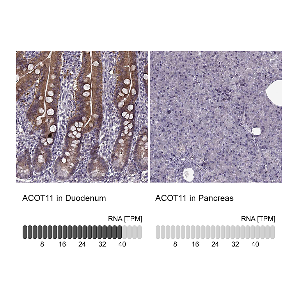 Atlas Antibodies Anti-ACOT11 Antibody