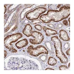 Atlas Antibodies Anti-ACOT1 Antibody