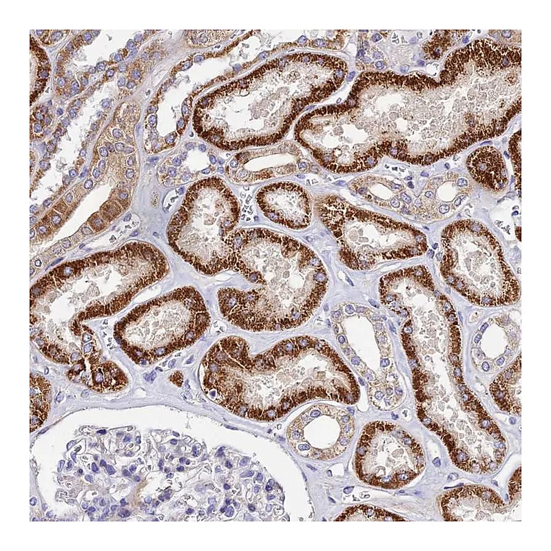 Atlas Antibodies Anti-ACOT1 Antibody