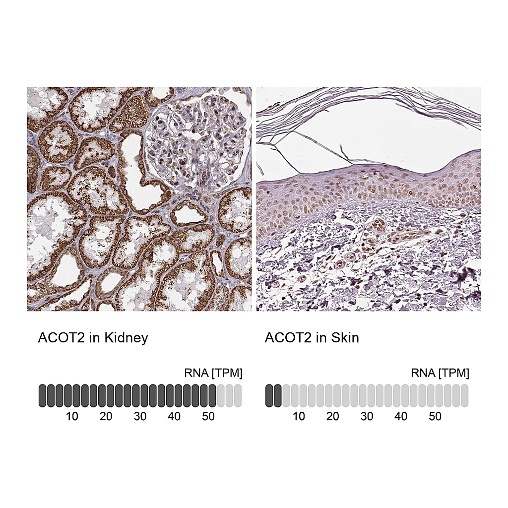 Atlas Antibodies Anti-ACOT2 Antibody