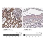 Atlas Antibodies Anti-ACOT2 Antibody