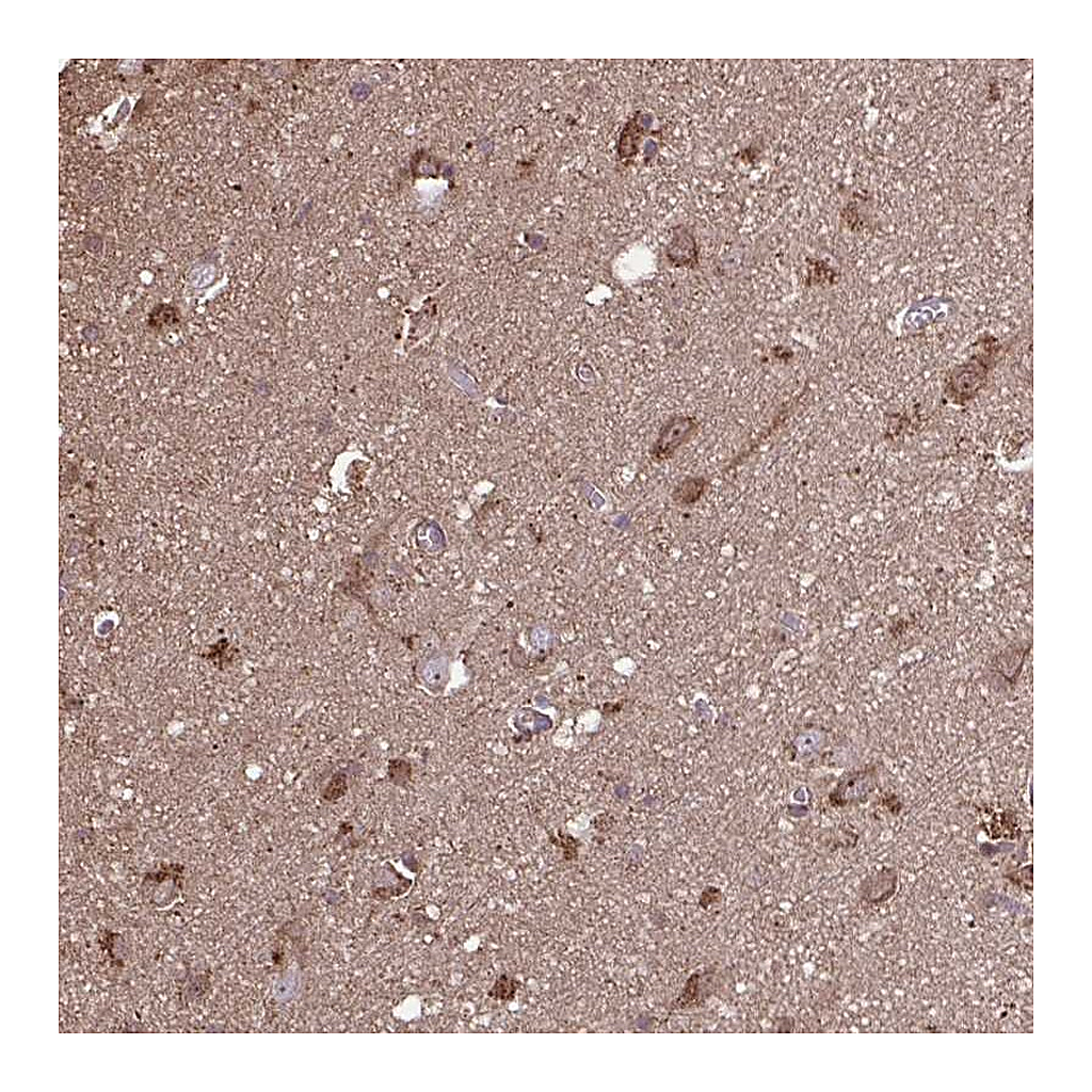 Atlas Antibodies Anti-ACOT6 Antibody