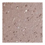 Atlas Antibodies Anti-ACOT6 Antibody
