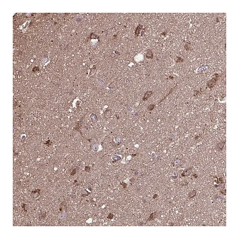 Atlas Antibodies Anti-ACOT6 Antibody