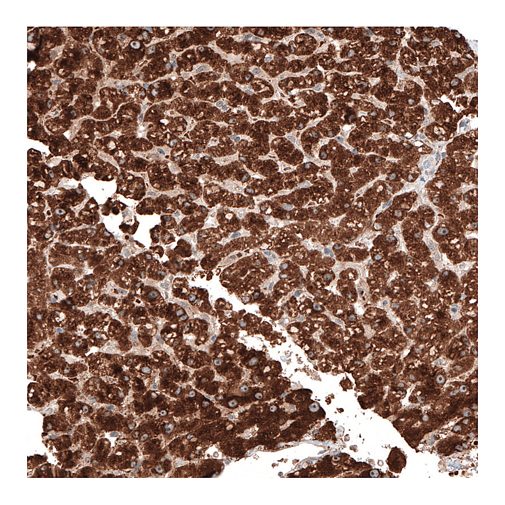 Atlas Antibodies Anti-ACOT4 Antibody