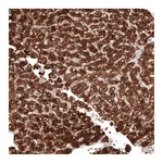 Atlas Antibodies Anti-ACOT4 Antibody