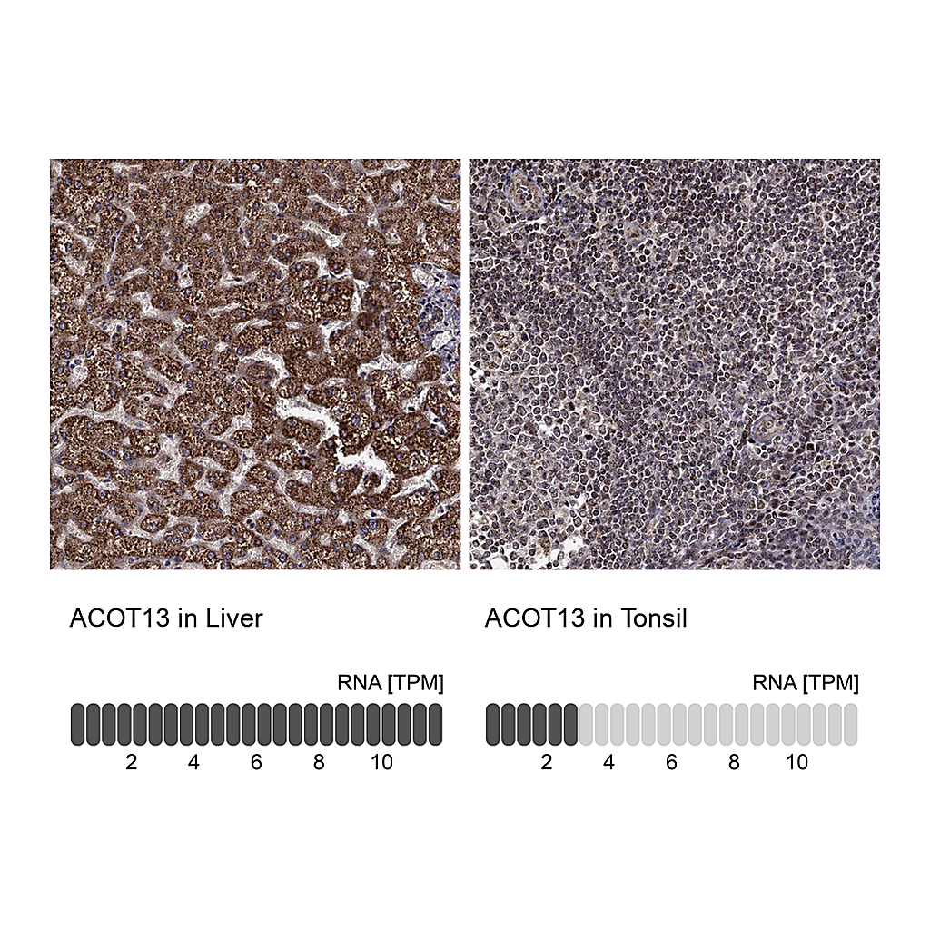 Atlas Antibodies Anti-ACOT13 Antibody