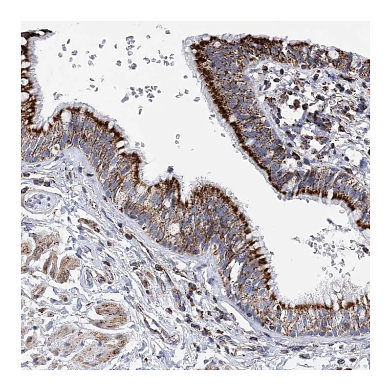 Atlas Antibodies Anti-ACOT9 Antibody