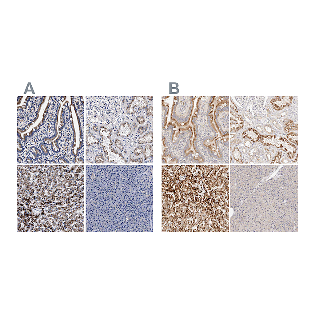 Atlas Antibodies Anti-ACOX1 Antibody