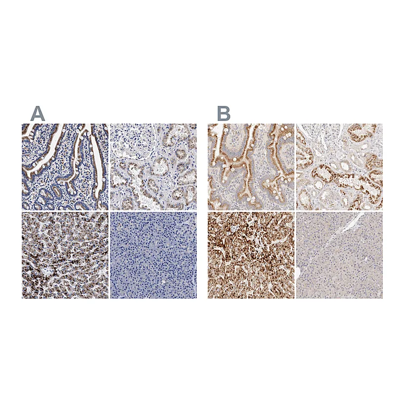 Atlas Antibodies Anti-ACOX1 Antibody
