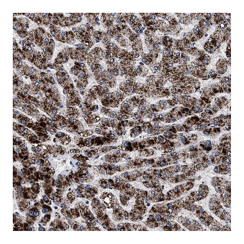 Atlas Antibodies Anti-ACOX1 Antibody