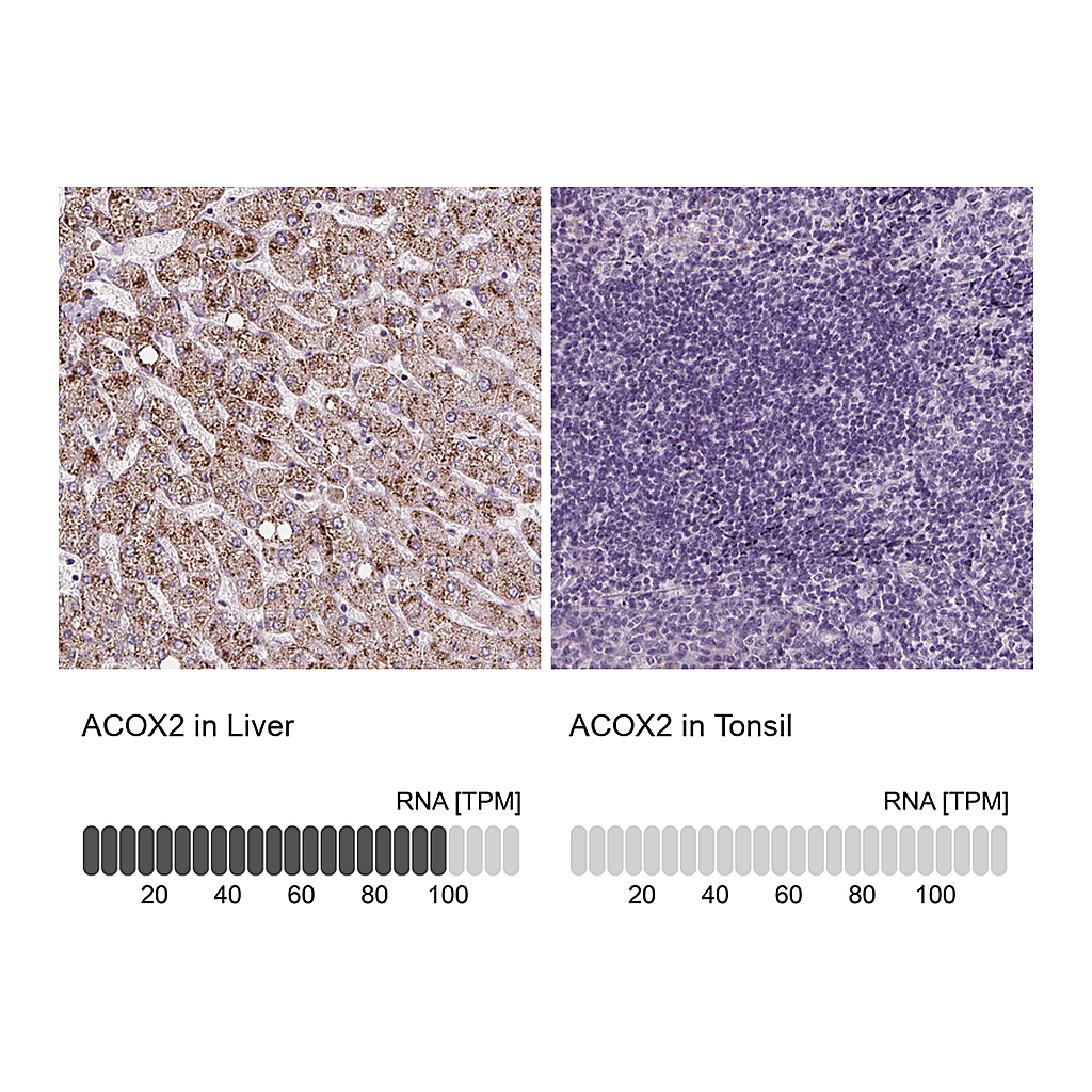 Atlas Antibodies Anti-ACOX2 Antibody