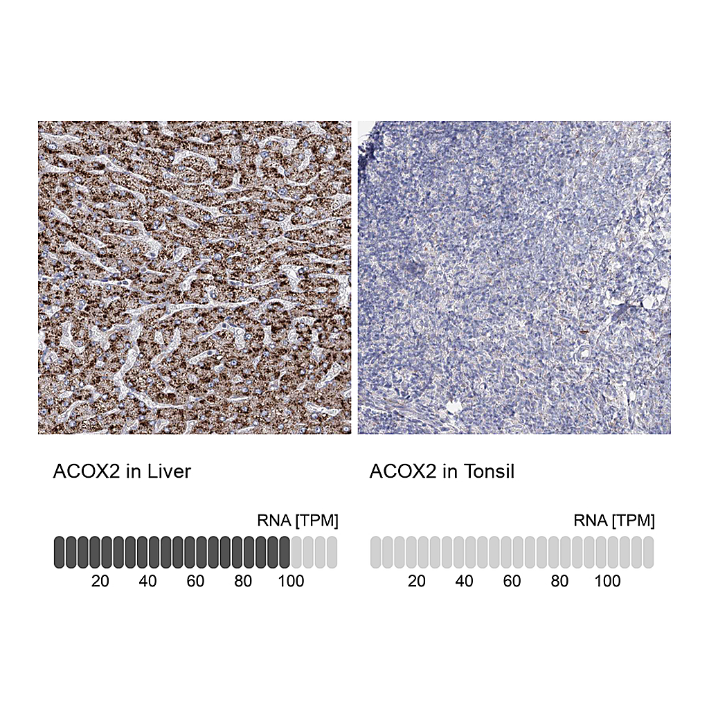 Atlas Antibodies Anti-ACOX2 Antibody