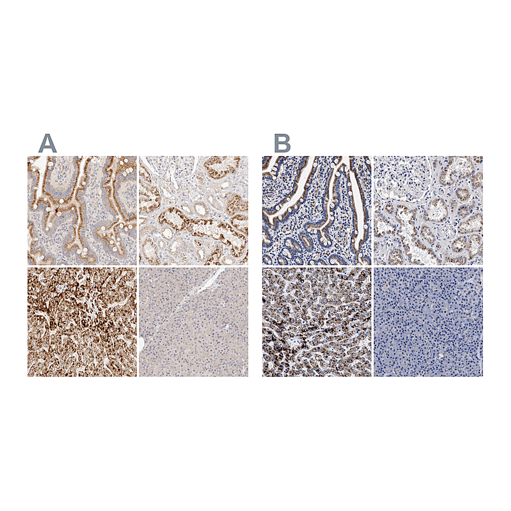 Atlas Antibodies Anti-ACOX1 Antibody