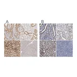 Atlas Antibodies Anti-ACOX1 Antibody