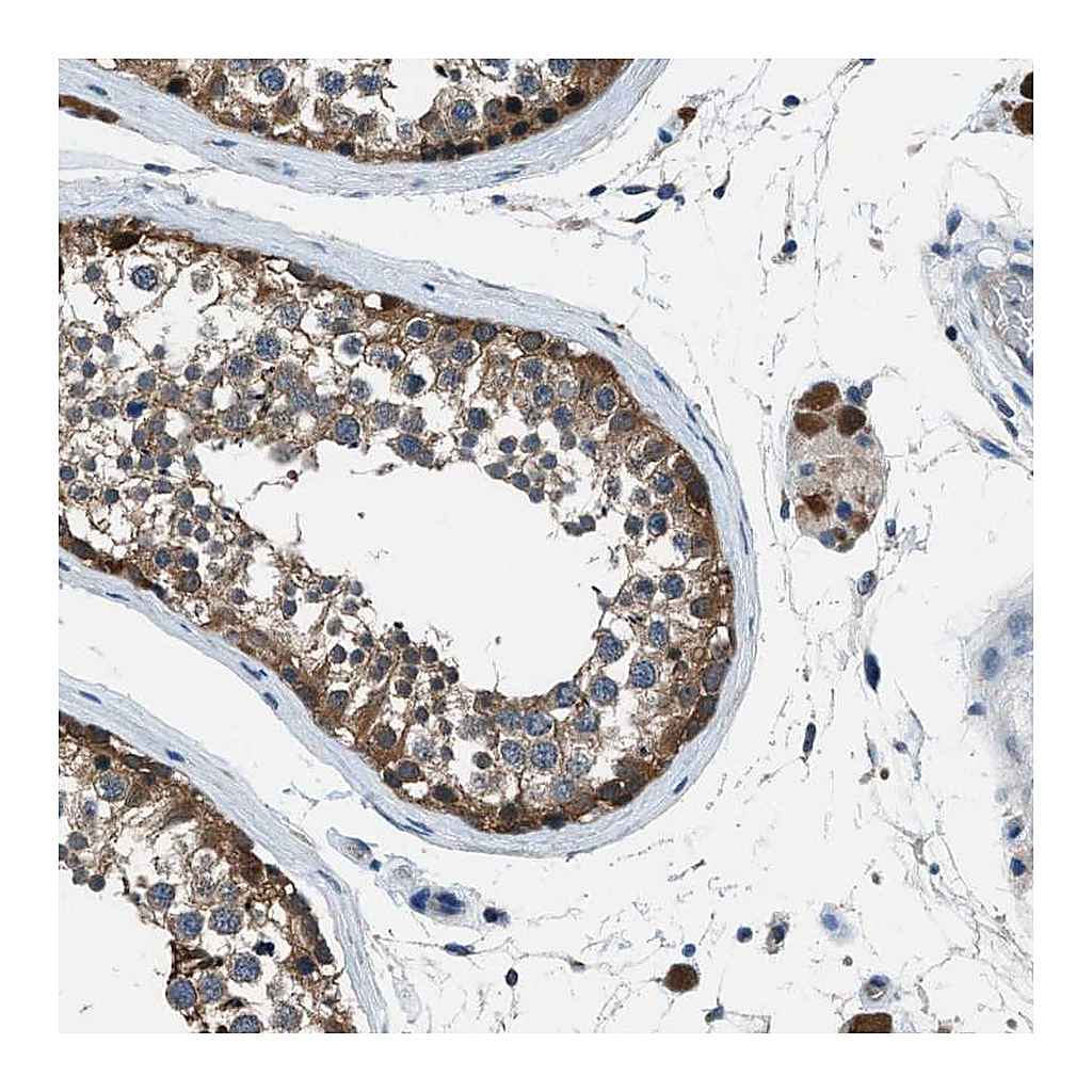 Atlas Antibodies Anti-ACP1 Antibody