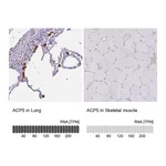 Atlas Antibodies Anti-ACP5 Antibody