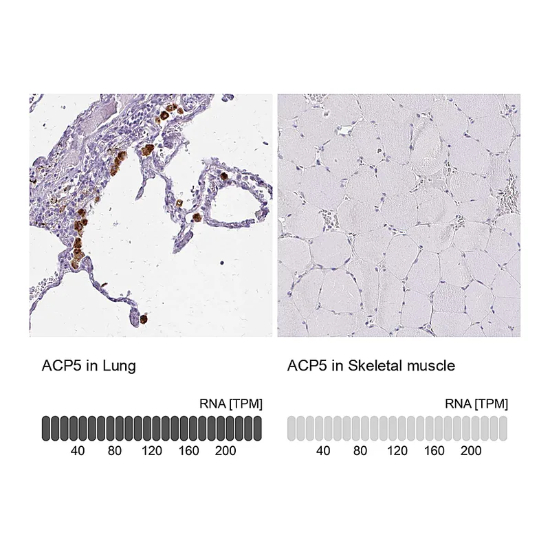 Atlas Antibodies Anti-ACP5 Antibody