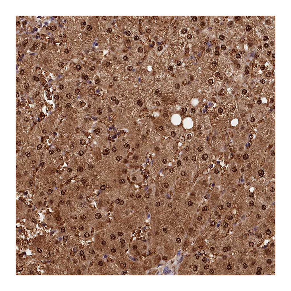 Atlas Antibodies Anti-ACP7 Antibody