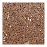 Atlas Antibodies Anti-ACP7 Antibody