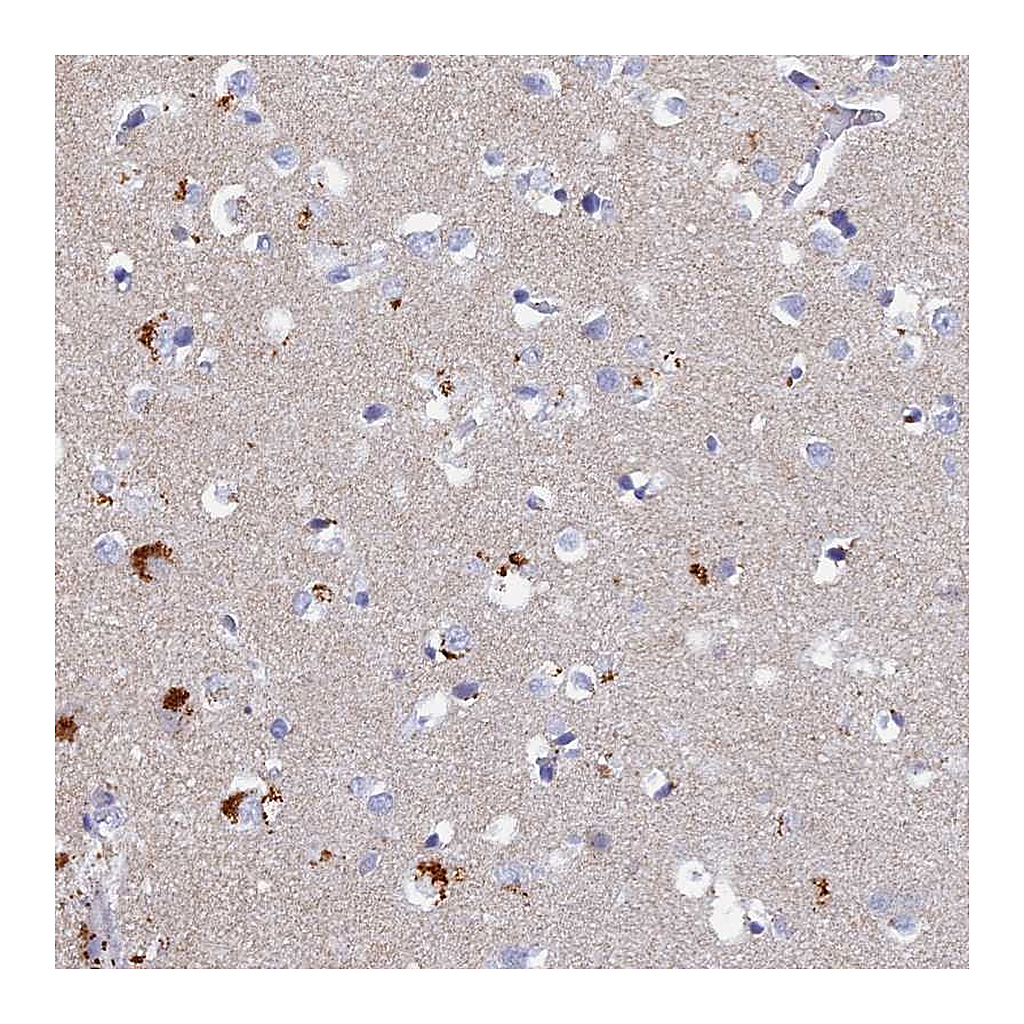 Atlas Antibodies Anti-ACP7 Antibody