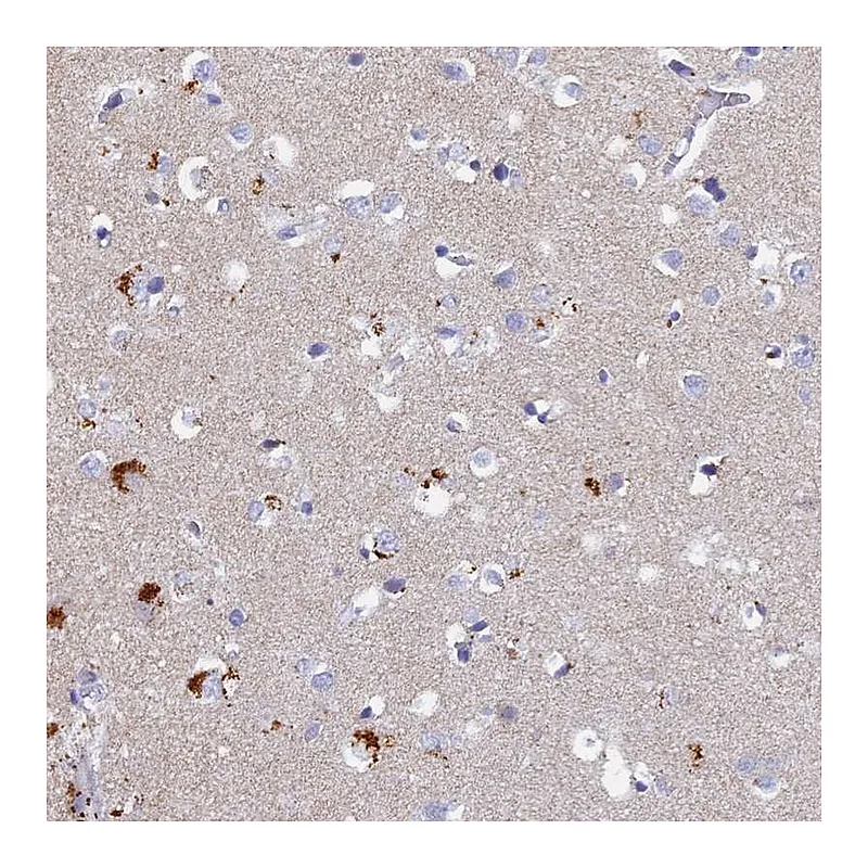 Atlas Antibodies Anti-ACP7 Antibody