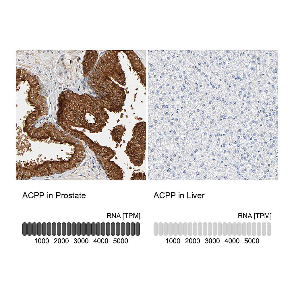 Atlas Antibodies Anti-ACPP Antibody