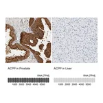 Atlas Antibodies Anti-ACPP Antibody