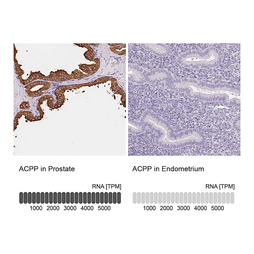 Atlas Antibodies Anti-ACPP Antibody
