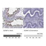 Atlas Antibodies Anti-ACRBP Antibody