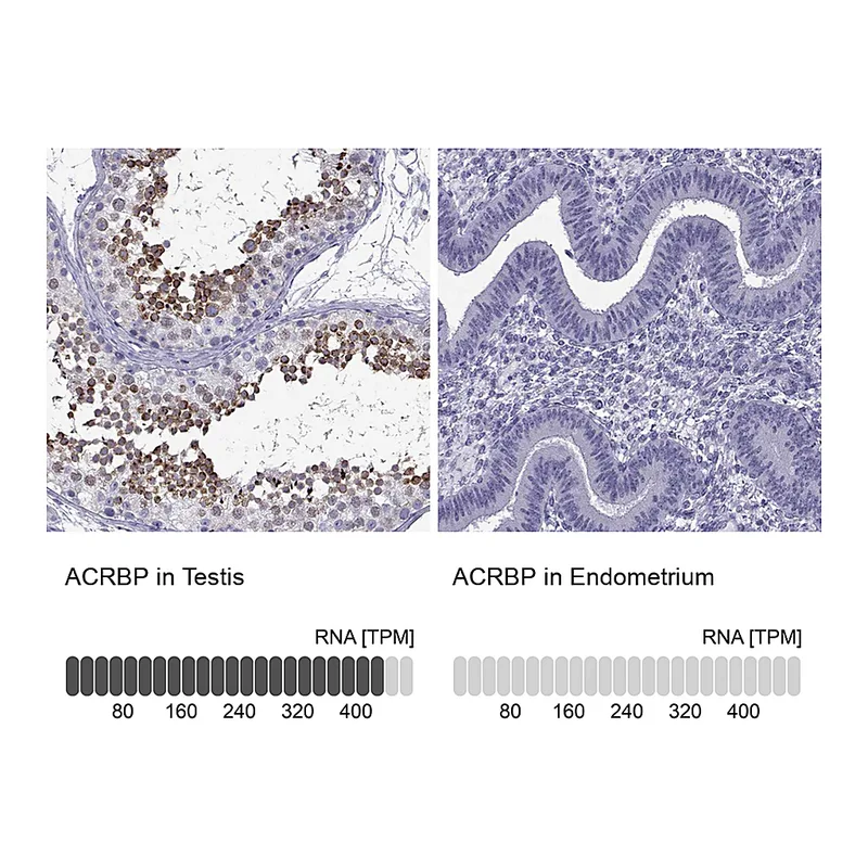 Atlas Antibodies Anti-ACRBP Antibody
