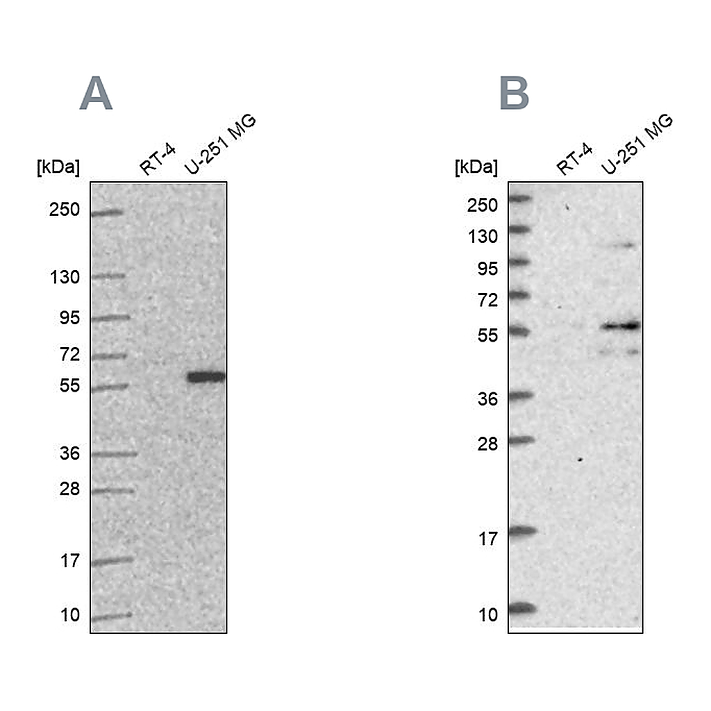 Atlas Antibodies Anti-ACSBG1 Antibody