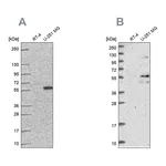 Atlas Antibodies Anti-ACSBG1 Antibody