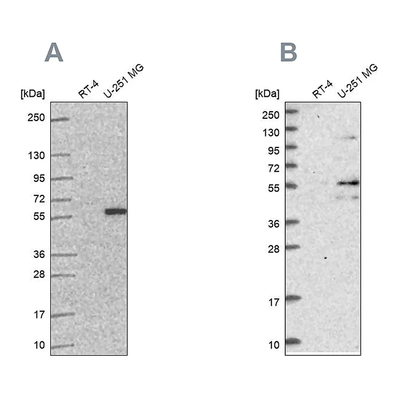 Atlas Antibodies Anti-ACSBG1 Antibody