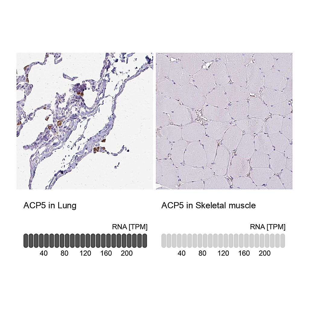 Atlas Antibodies Anti-ACP5 Antibody