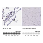 Atlas Antibodies Anti-ACP5 Antibody