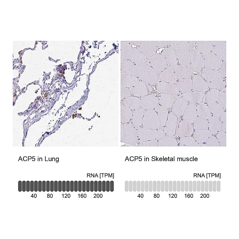 Atlas Antibodies Anti-ACP5 Antibody