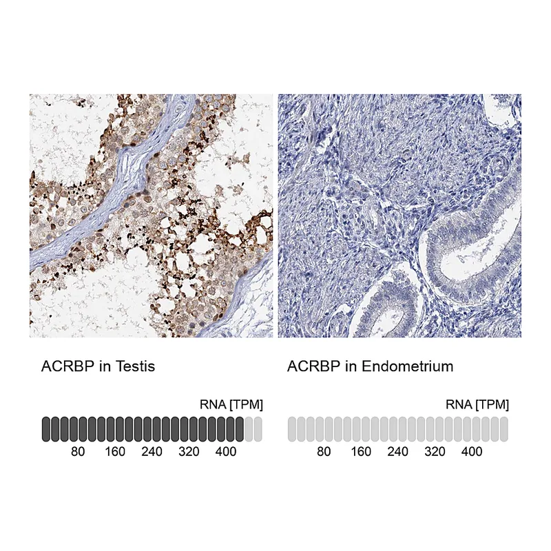 Atlas Antibodies Anti-ACRBP Antibody
