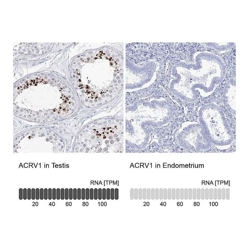 Atlas Antibodies Anti-ACRV1 Antibody
