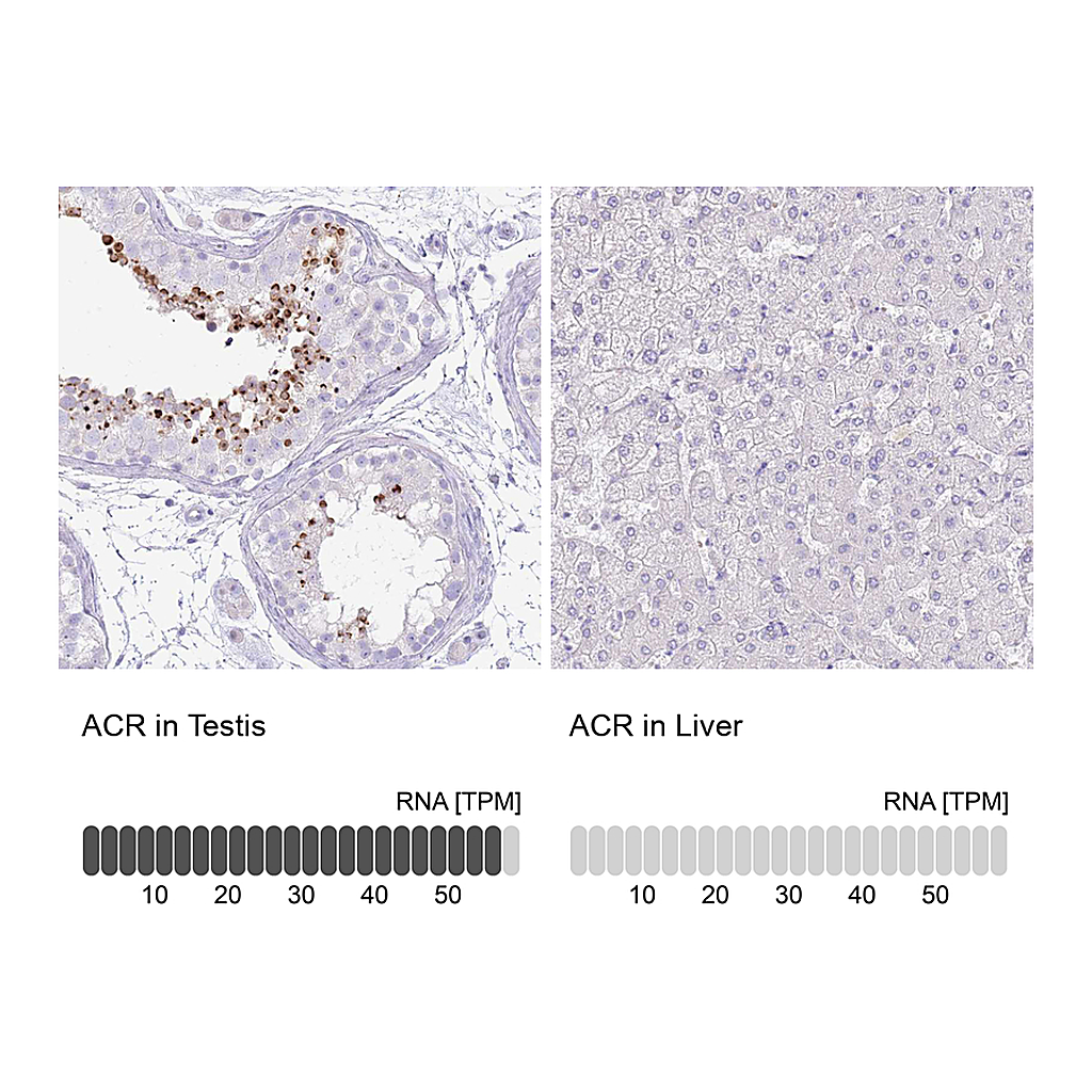 Atlas Antibodies Anti-ACR Antibody