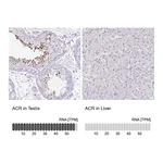 Atlas Antibodies Anti-ACR Antibody