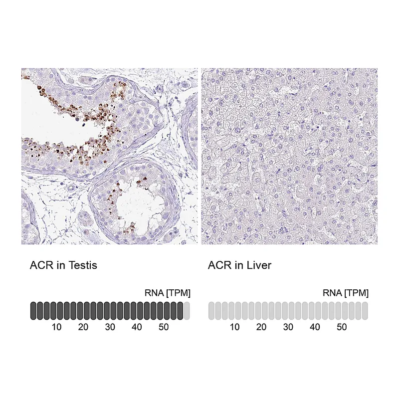 Atlas Antibodies Anti-ACR Antibody