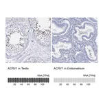 Atlas Antibodies Anti-ACRV1 Antibody