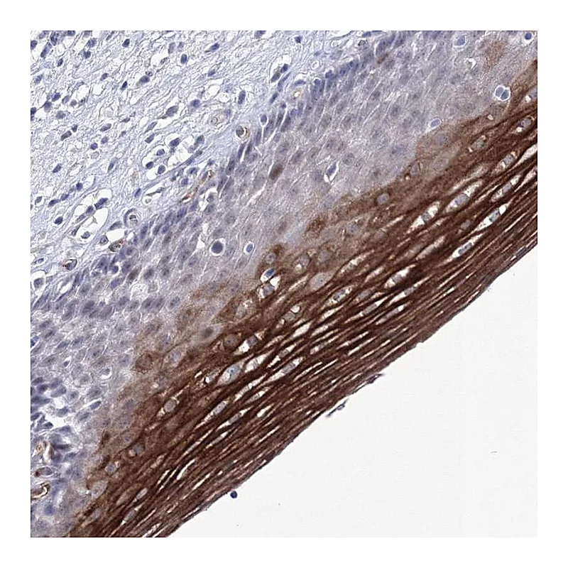 Atlas Antibodies Anti-ACOX3 Antibody