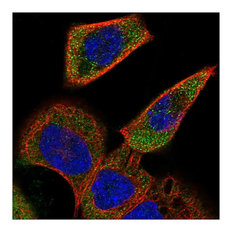Atlas Antibodies Anti-ACOXL Antibody